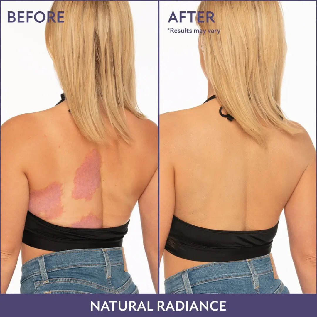 Body Coverage Perfector